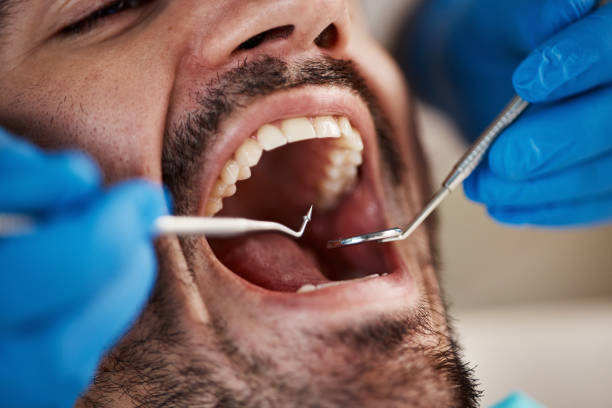 Best Knocked-Out Tooth Emergency  in Matoaca, VA
